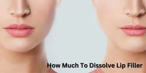 How Much To Dissolve Lip Filler
