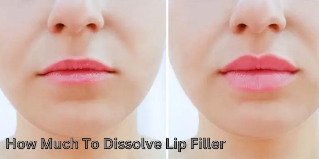 How Much To Dissolve Lip Filler