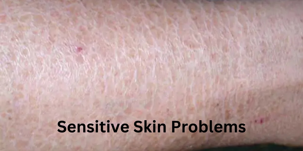 sensitive skin problems